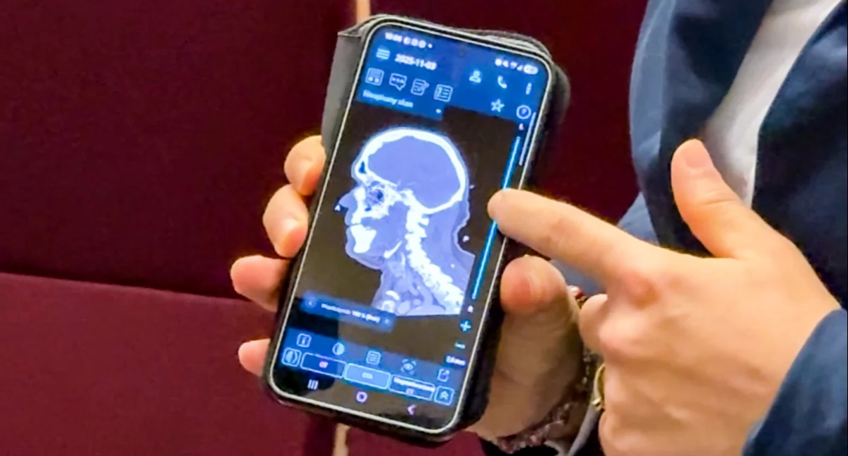 Zdrowie, dolnośląskich szpitali połączyło siły Wrocławiu koordynatorem pierwszej Polsce Sieci Udarowej - zdjęcie, fotografia