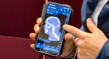 12 dolnośląskich szpitali połączyło siły. USK we Wrocławiu koordynatorem pierwszej w Polsce Sieci Udarowej